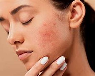 Skin Care Advices for Your Special Event