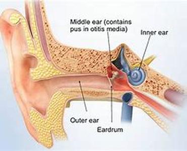 Surgical Solutions If the Appearance of Your Ears Bothers You