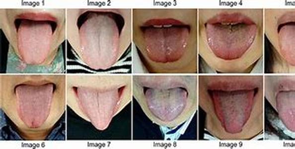 Today's Orthodontic Treatment: Comfortable, Convenient
