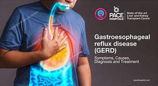 Acid Reflux and Heartburn Natural Remedies Part II