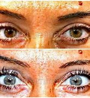 The Symptoms Menopause Changes Estrogen And Progesterone Levels