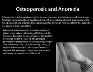 Osteoarthritis: Cause and Symptoms