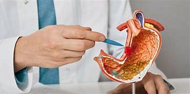 Understanding Digestion