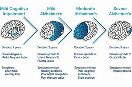 What Are The Different Types Of Sleeping Disorders
