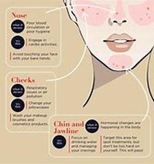 What Bacteria Causes Eye Styes
