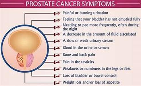 Prostate Gland  A human males anatomical make-up is composed of several glands, one of which is the prostate gland