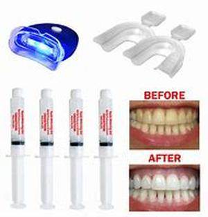Teeth whitening for a bright smile