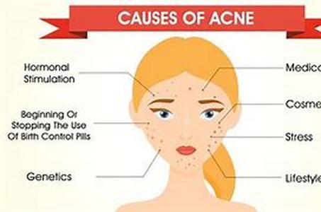 How to Manage and Treat Seasonal Allergy Symptoms