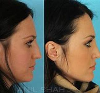 Acne Skin Care Centers