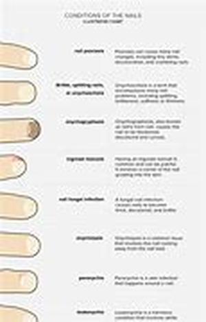 Find Out What Really Causes Acne