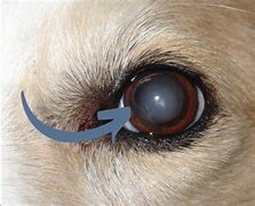 Keyword Phrase: Cataract Surgery In Colorado