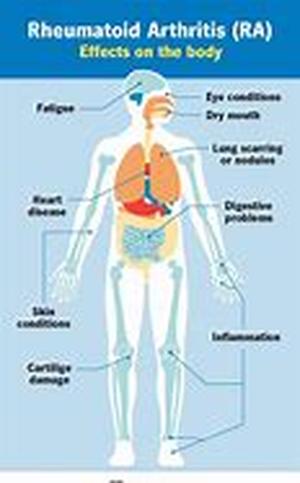 Researches of Pueraria Mirifica