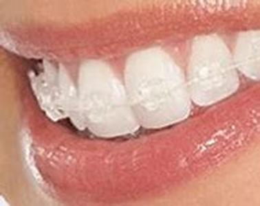 Adult Acne Treatments