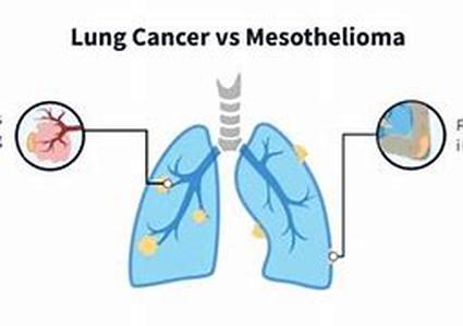 Asbestos Disease  Do you know what is the culprit of a grave medical condition that can take away your life in the years to come