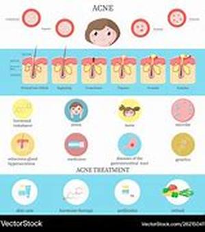 Acne at its Worst - Uncommon Forms Which Can Disfigure