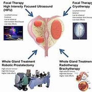 Prostate Biopsy  When men gets older, one part of their reproductive system could be affected and might give them problem