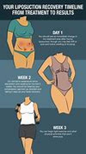 Things to avoid when trying to lose weight