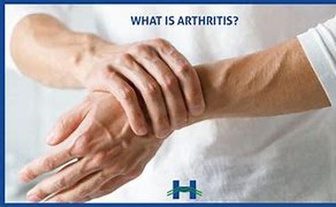 Gastroesophageal Reflux Disease (GERD) Information
