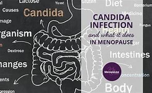 Menopause and Insomnia