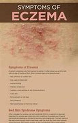 Eczema - Causes And Treatment