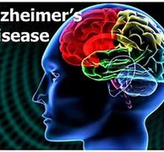 Alzheimer GPS Tracking