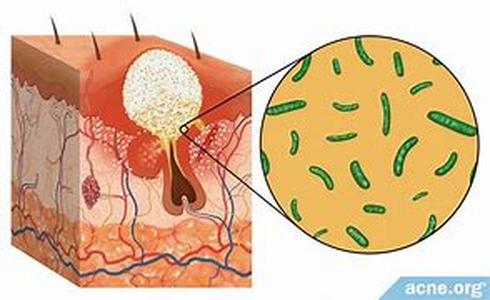 Back Pain Treatment: Variety Of Options Available