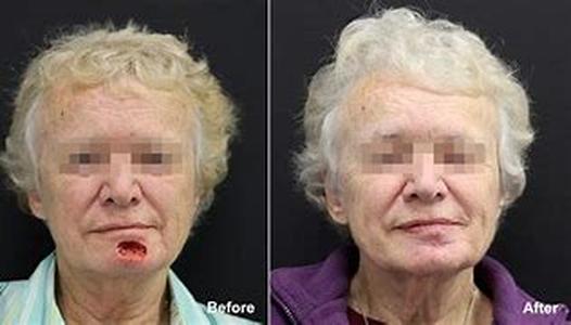 Plastic Surgery