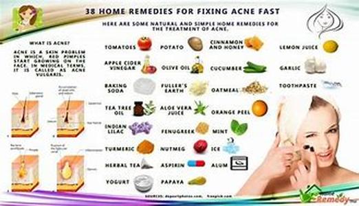 Acne Treatment - Know About All Topical Treatments