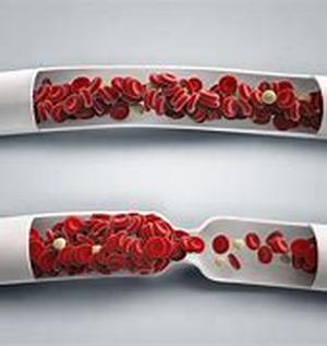 Can Exercise harm you