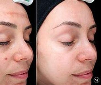 Skin Health Secrets: How to apply skin care products