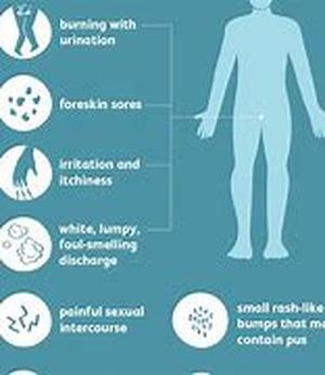 Xylitol the Cure for Caries