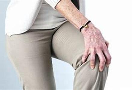 Arthritis in Dogs