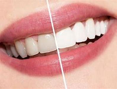 Cosmetic Surgery  Will It Really Change Your Life