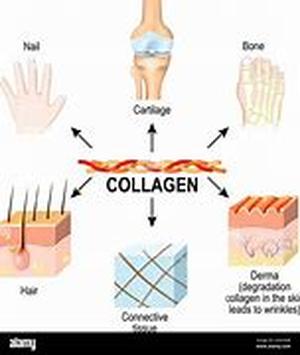 Collagen Injections Replenish Your Skins Natural Moisture  Summary: Collagen injections can repair the signs of aging temporarily or permanently