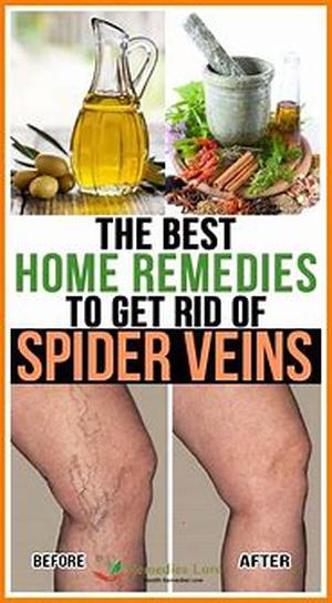 Home Remedies for Snoring People, Why Not