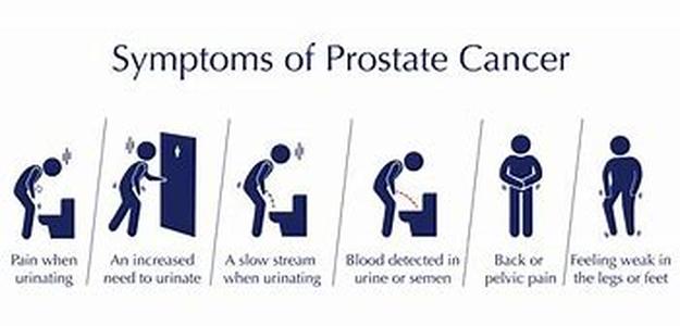 Prostate Health and Saw Palmetto  For a man to assume that sexual decline is some natural process in aging is severe misinformation