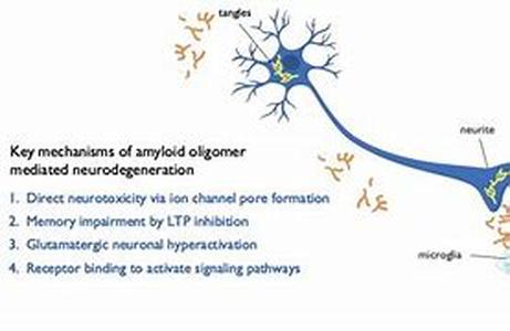 Alzheimers Test