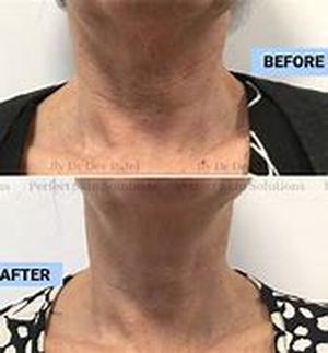 Mercury-Free Dentistry - Is There Poison In Your Mouth