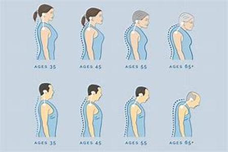 The Acne and Diet Connection