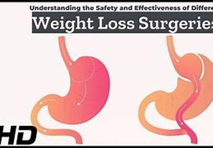 Weight Loss Secrets You Already Know
