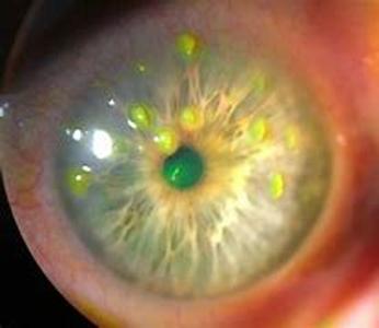 Consumer Alert - Dangerous Vitamins Invade Marketplace