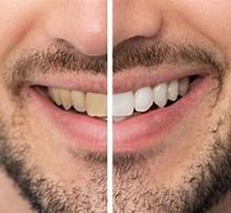 DENTAL CARE  Whos Afraid To Go