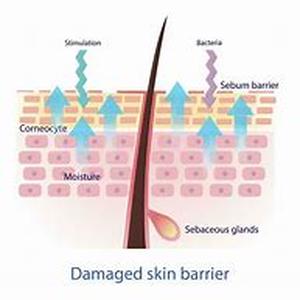 Skin cancer and sun exposure whilst at work