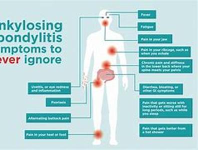 Arthritis Treatments- The Natural Way