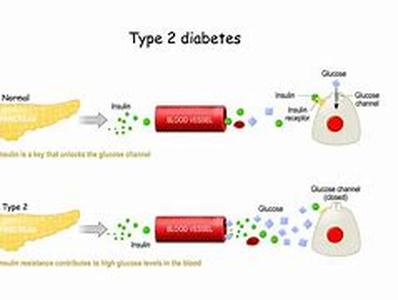 High Cholesterol in Diabetics