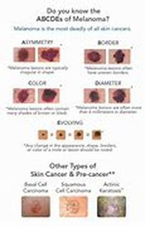 Skin Care Acne Control  Have you experienced waking up in the morning where you are greeted with a zit on your face