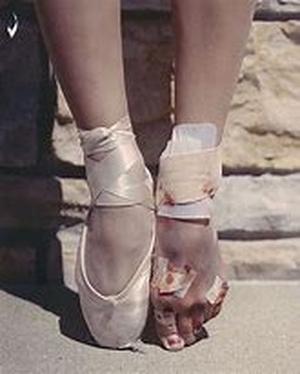 What Causes Psoriasis