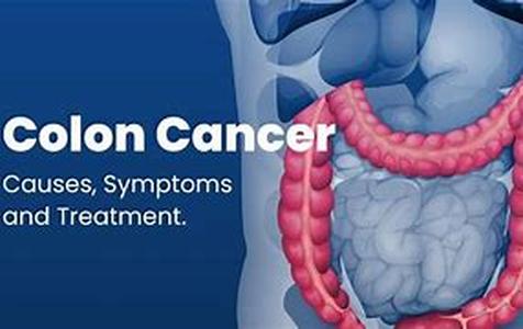 Colon Detox Diet  The colon is one of the vital organs in the gastrointestinal tract, and sadly one of the most neglected