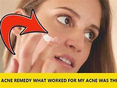 Acne Program - Step 4:  Adding Essential Fatty Acids To Your Diet