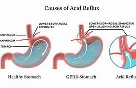 Common Men's Health Issues that you Should be Concerned About